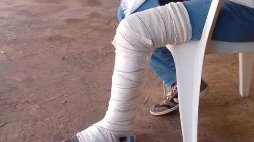 Hospital que enfaixou perna de idosa com calça diz que ação foi provisória