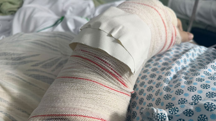 Torcedor de Assis se machuca ao comemorar gol da virada do Brasil e é hospitalizado